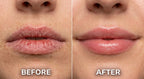PDRN Peptide Lip Balm