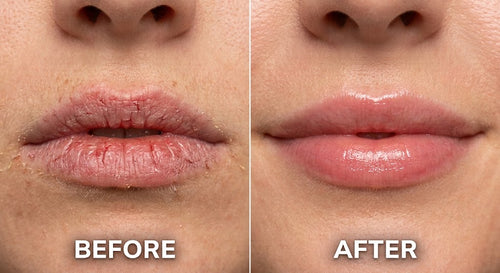 PDRN Peptide Lip Balm
