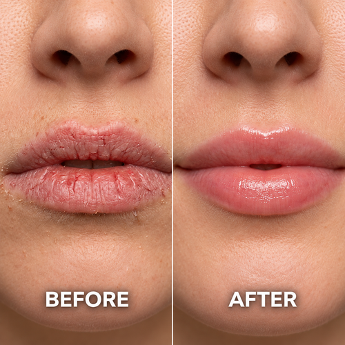 PDRN Peptide Lip Balm